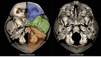 Understanding Skull Base Anatomy: Structure, Functions, and Clinical Significance